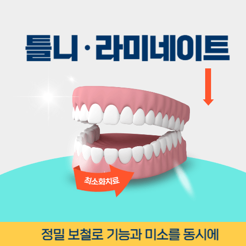 안양치과 안양시 치과 틀니 라미네이트