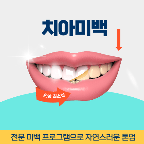 안양치과 안양시 치과 치아미백
