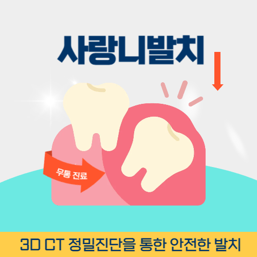 안양치과 안양시 치과 사랑니 발치