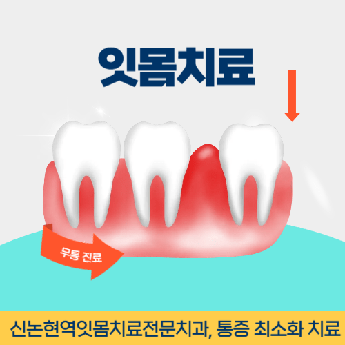 안양치과 안양시 치과 잇몸치료